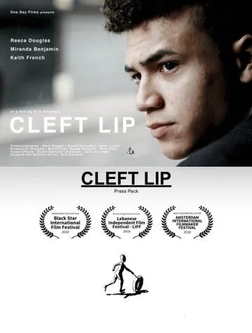 Заячья губа / Cleft Lip (2017)