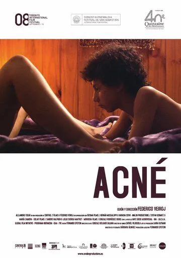 Угри / Acné (2008)